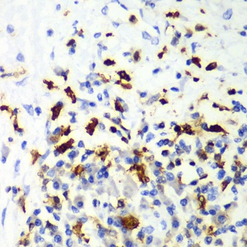 CAPG Antibody, KO Validated