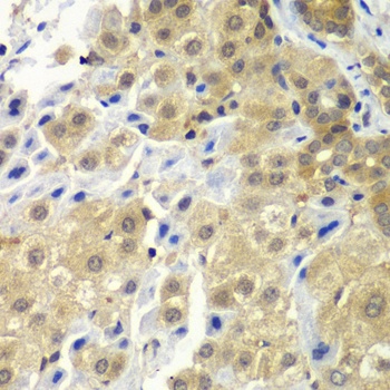 SGTA Antibody, KO Validated