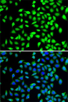 SGTA Antibody, KO Validated