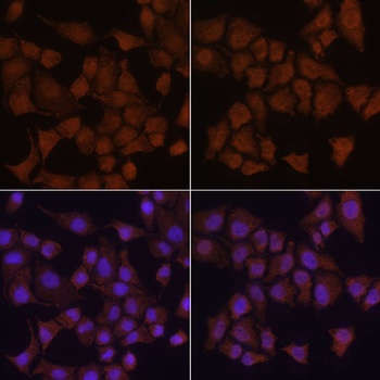 MAP1LC3B Antibody