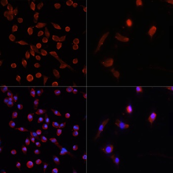 MAP1LC3B Antibody