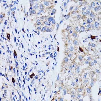 MAP1LC3B Antibody