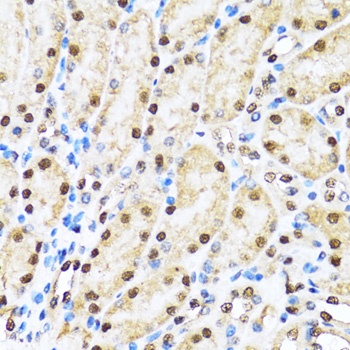 MAP1LC3B Antibody