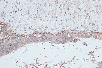 MAP1LC3B Antibody