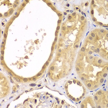 XIAP Antibody, KO Validated