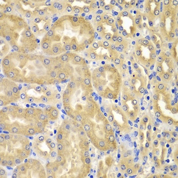XIAP Antibody, KO Validated