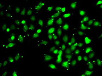 XIAP Antibody, KO Validated