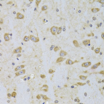 EEF1B2 Antibody, KO Validated