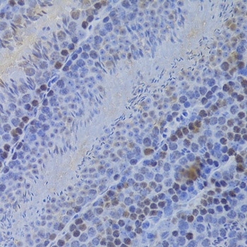 HELLS Antibody, KO Validated