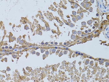 HDAC8 Antibody, KO Validated