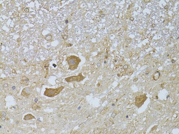HDAC8 Antibody, KO Validated
