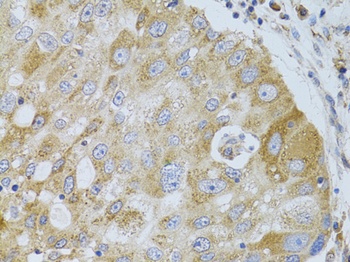 HDAC8 Antibody, KO Validated