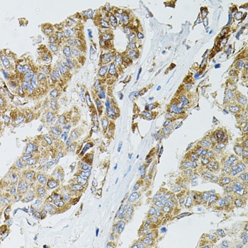 SIRT3 Antibody, KO Validated