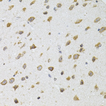 SIRT3 Antibody, KO Validated