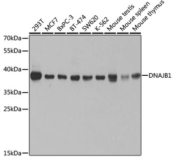 DNAJB1 Antibody, KO Validated
