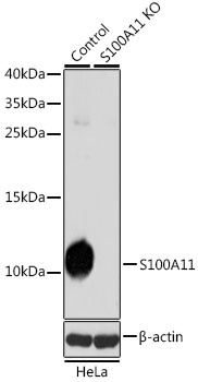 S100A11 Antibody, KO Validated