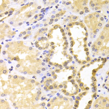 S100A11 Antibody, KO Validated