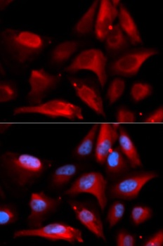S100A11 Antibody, KO Validated