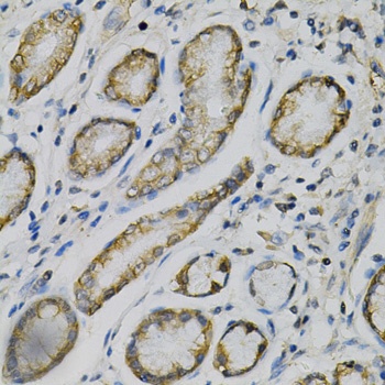 GLUL Antibody, KO Validated