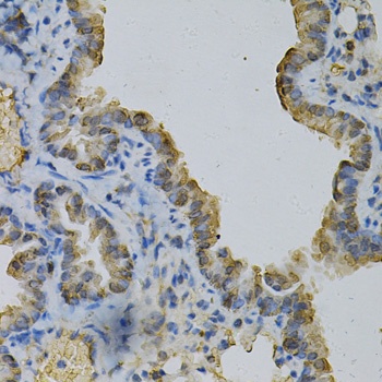 GLUL Antibody, KO Validated