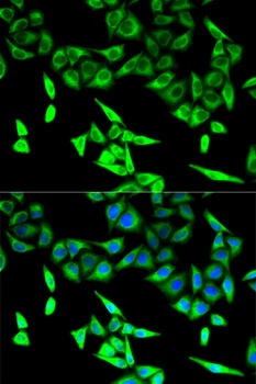 HADHA Antibody, KO Validated