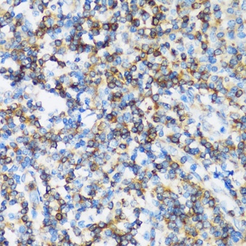 ARHGEF1 Antibody, KO Validated