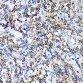 ARHGEF1 Antibody