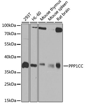 PPP1CC Antibody, KO Validated