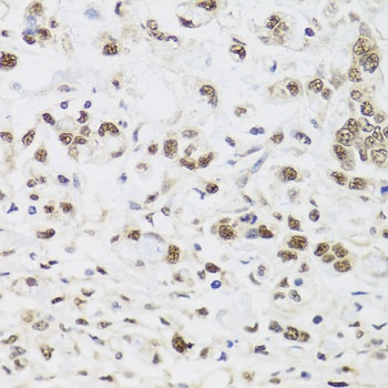 PPP1CC Antibody, KO Validated