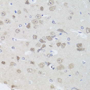 PPP1CC Antibody, KO Validated