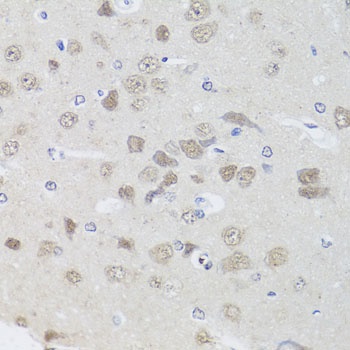 PPP1CC Antibody