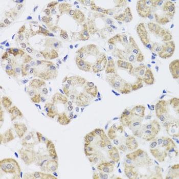 PPP1CC Antibody, KO Validated