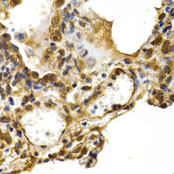 AIF Antibody, KO Validated