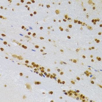HMGB1 Antibody, KO Validated