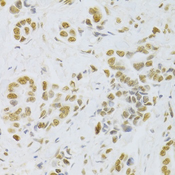 HMGB1 Antibody, KO Validated