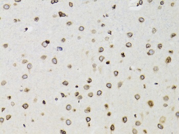 TMPO Antibody, KO Validated