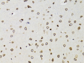 TMPO Antibody