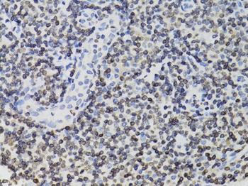 TMPO Antibody, KO Validated
