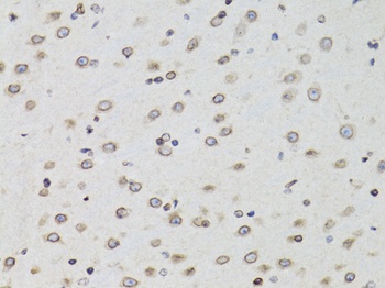 TMPO Antibody