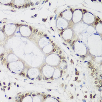 CBX3 Antibody, KO Validated