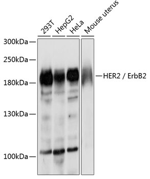 HER2 / ErbB2 Antibody, KO Validated