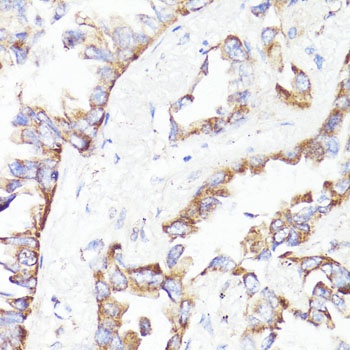 HER2 / ErbB2 Antibody, KO Validated