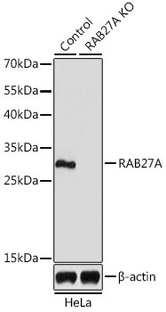 RAB27A Antibody, KO Validated