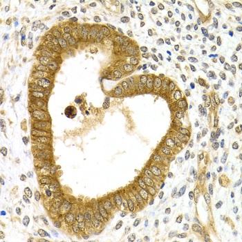 RAB27A Antibody, KO Validated