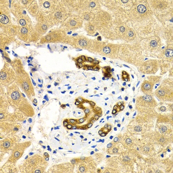 RAB27A Antibody