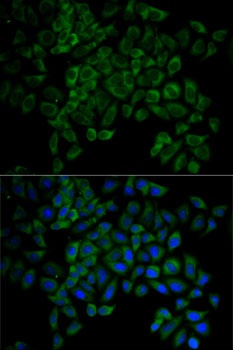 RAB27A Antibody, KO Validated