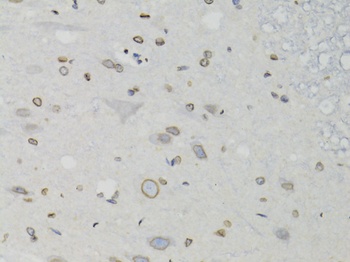 Lamin B1 Antibody, KO Validated