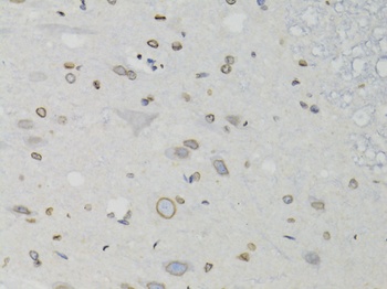 LMNB1 Antibody