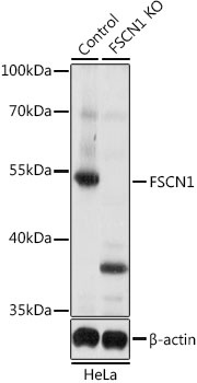 FSCN1 Antibody, KO Validated