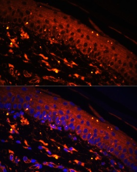FSCN1 Antibody, KO Validated